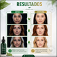 【Un solo rociado, eliminación instantánea】Spray quitamanchas blanqueador